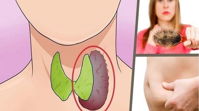 poremećaj štitne žlijezde